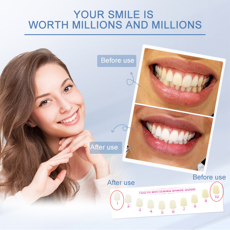 2PCS 35%CP Professional Level Teeth Whitening Pen