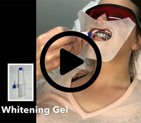 Video Guide On How to Use Our Professional Teeth Whitening Kit