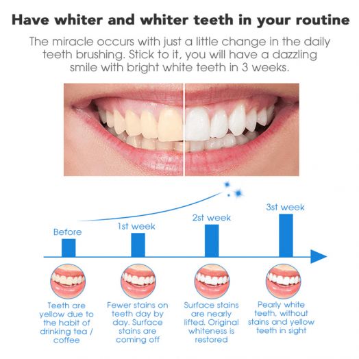 2PCS 35%CP Professional Level Teeth Whitening Pen
